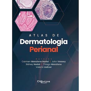 Atlas De Dermatologia Perianal