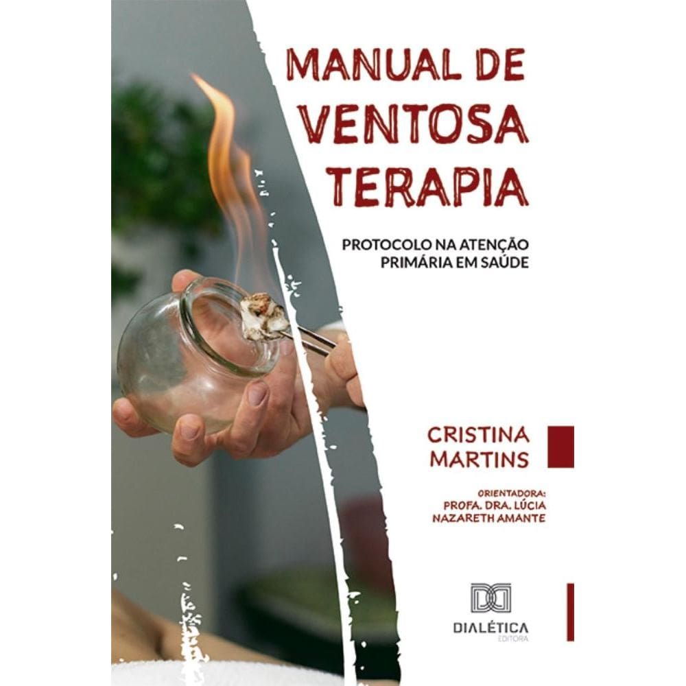 Manual de Ventosaterapia: protocolo na Atenção Primária em Saúde