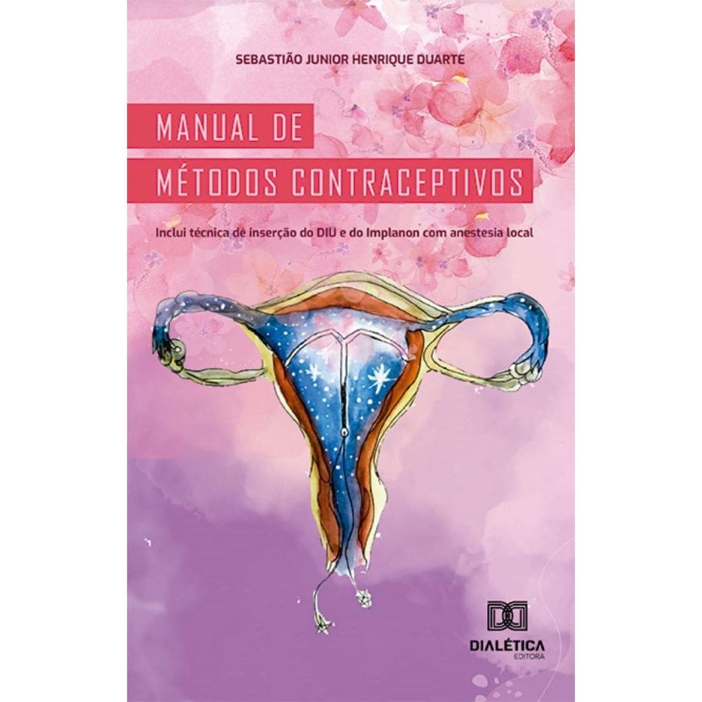 Manual de métodos contraceptivos: inclui técnica de inserção do DIU e do Implanon com anestesia local