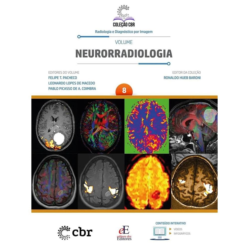Coleção CBR Volume 8: Neurorradiologia