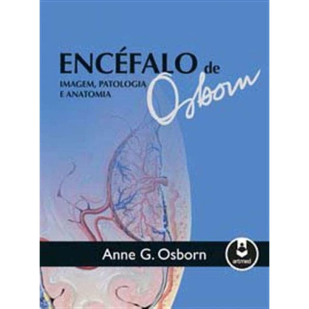 Encefalo De Osborn: Imagem, Patologia e Anatomia