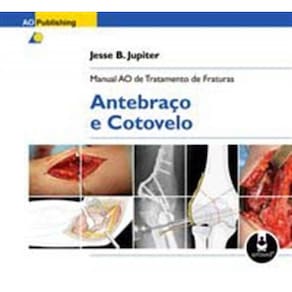 Manual Ao De Tratamento De Fraturas