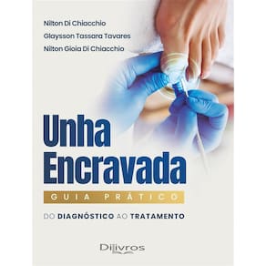 Unha Encravada Guia Pratico
