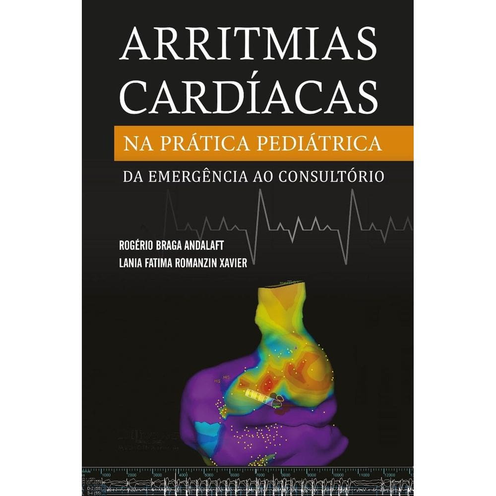 Arritmias Cardiacas Na Pratica Pediatrica