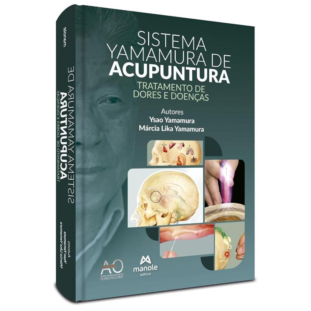 Sistema Yamamura de Acupuntura