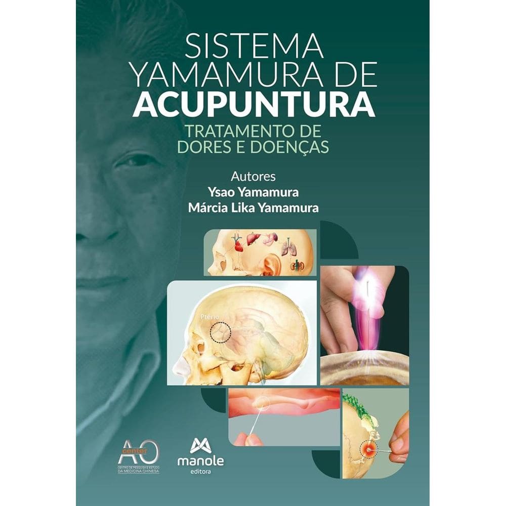 Sistema Yamamura de Acupuntura: Tratamento de Dores e Doenças