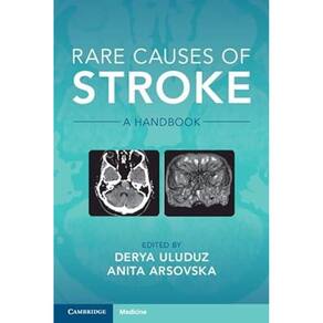 Rare Causes Of Stroke