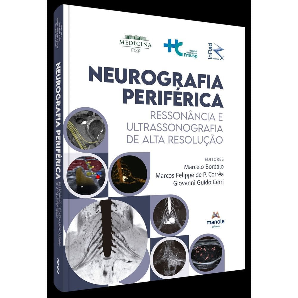 Neurografia Periférica - Ressonância e Ultrassonografia de Alta Resolução - 01Ed/24