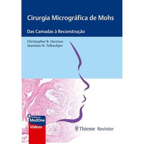 Cirurgia Micrográfica de Mohs: Das Camadas À Reconstrução