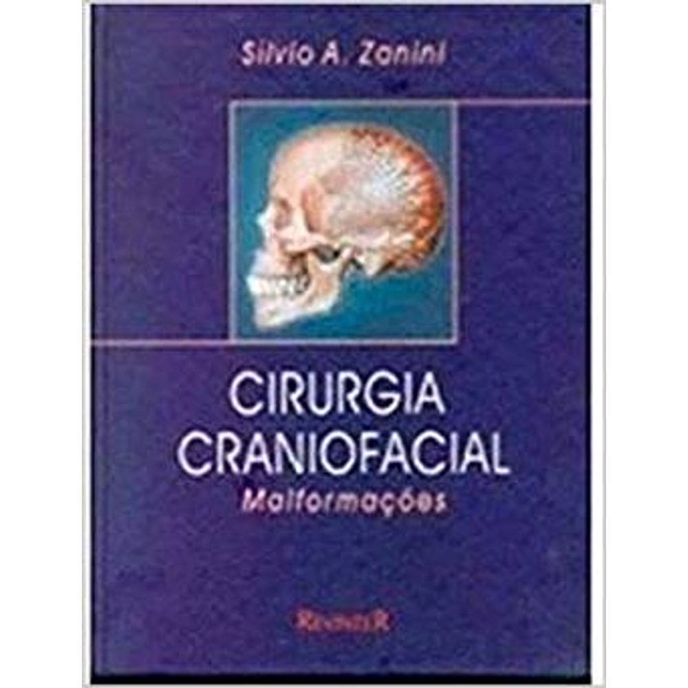 Cirurgia Craniofacial. Malformações