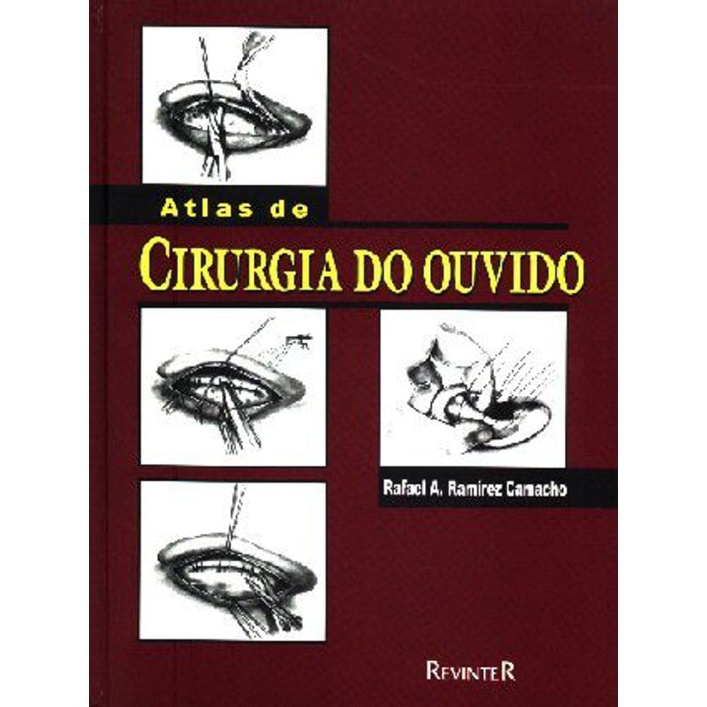 Atlas de Cirurgia do Ouvido