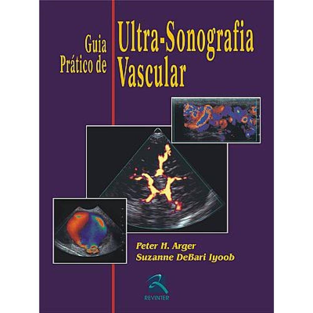 Guia Prático De Ultra-Sonografia Vascular