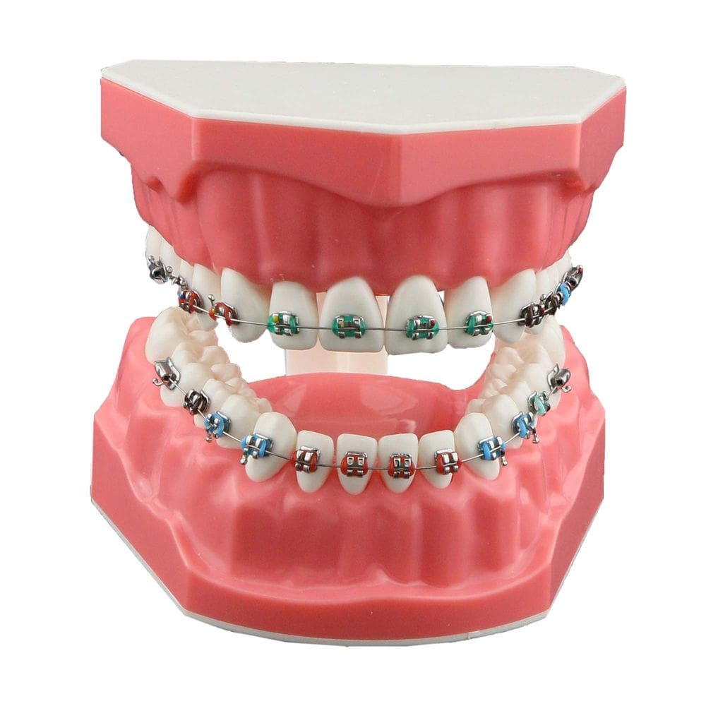 Modelo de demonstração odontológica Dentalmall Typodonts Orthodontics