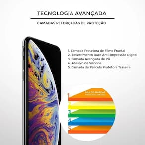 Película Hydrogel Para Doogee S60 - Gshield