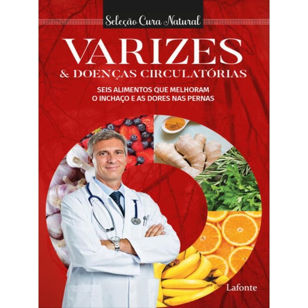 Varizes E Doenças Circulatórias