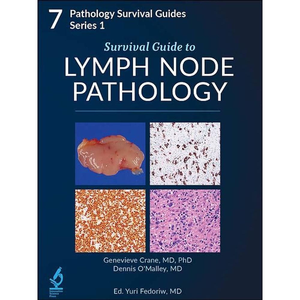 Survival Guide To Lymph Node Pathology