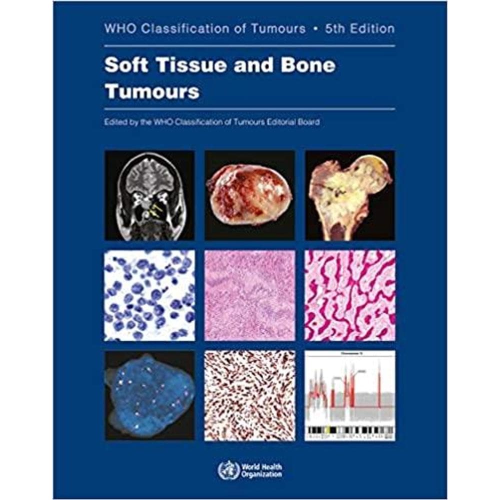 Soft Tissue And Bone Tumours