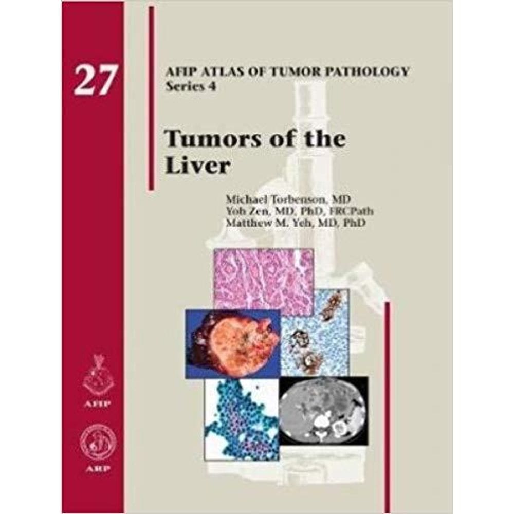 Tumors Of The Liver (Afip Atlas Of Tumor Pathology Series 4)