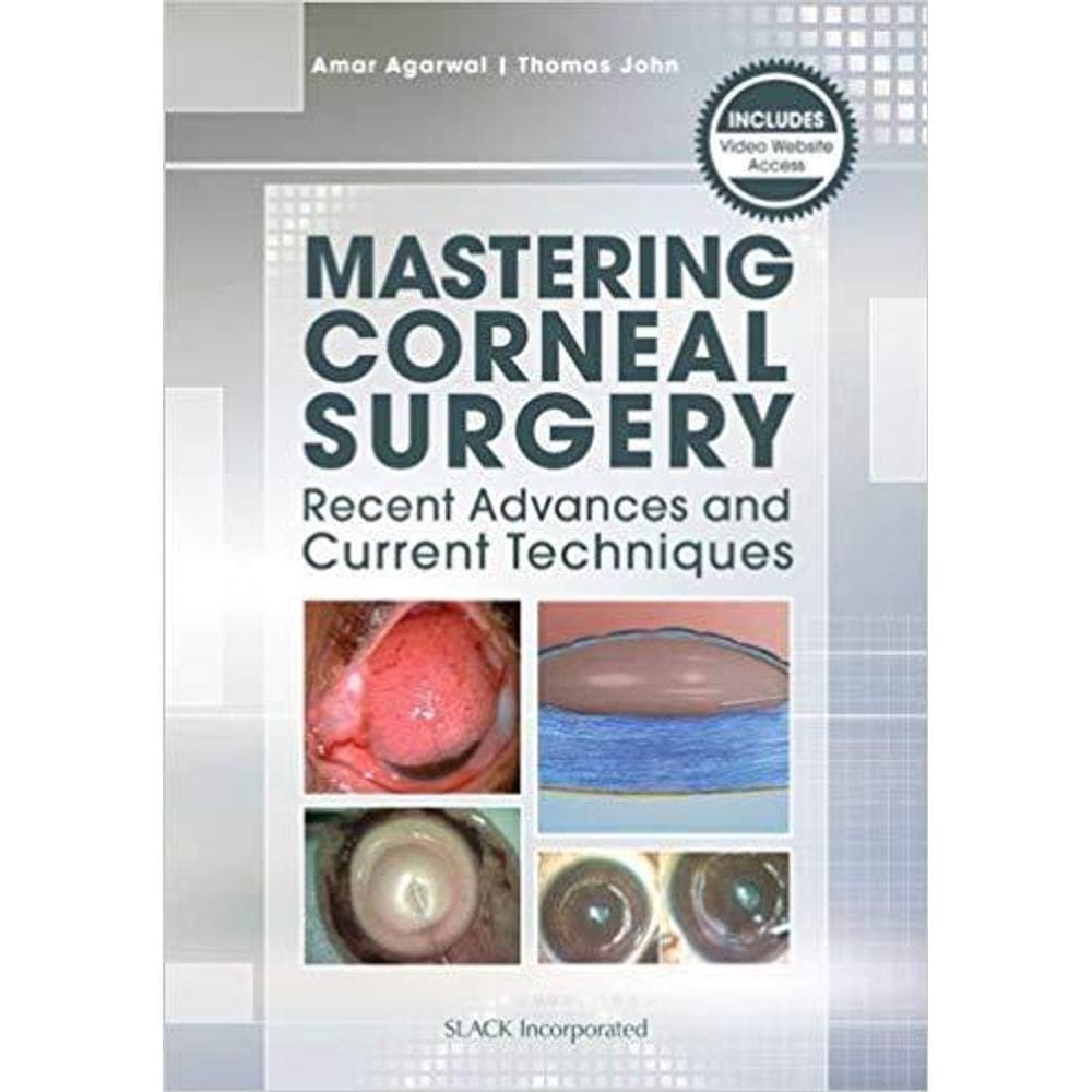 Mastering Corneal Surgery