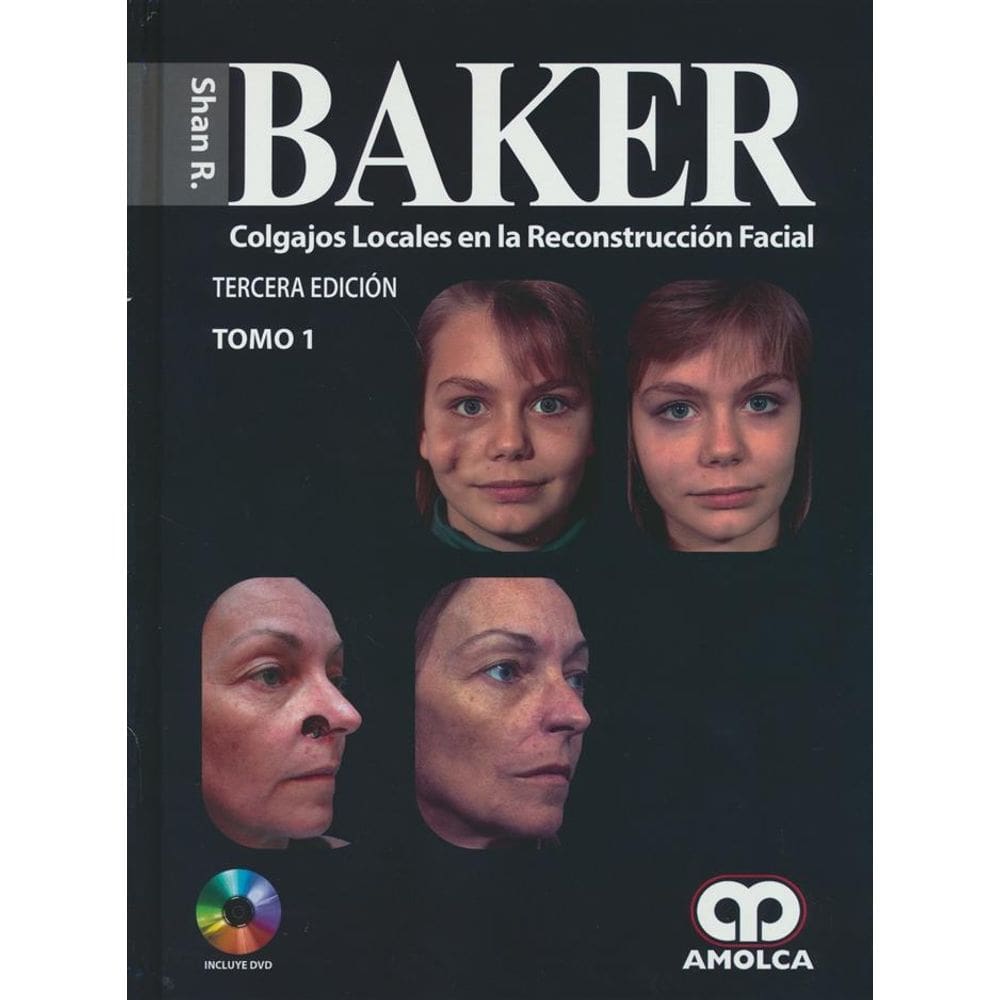 Colgajos Locales En La Reconstruccion Facial 2 Vols