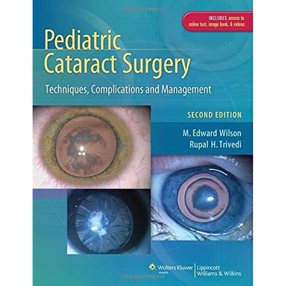 Pediatric Cataract Surgery