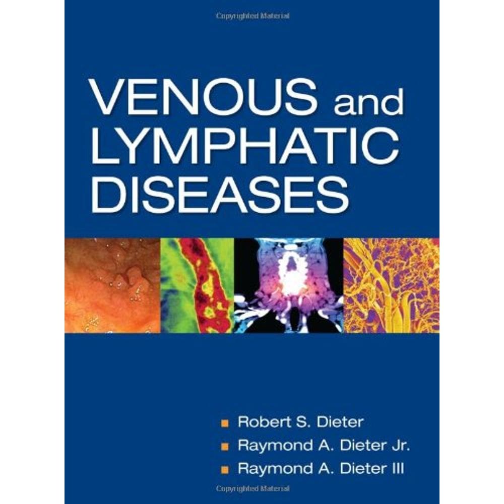 Venous And Lymphatic Diseases