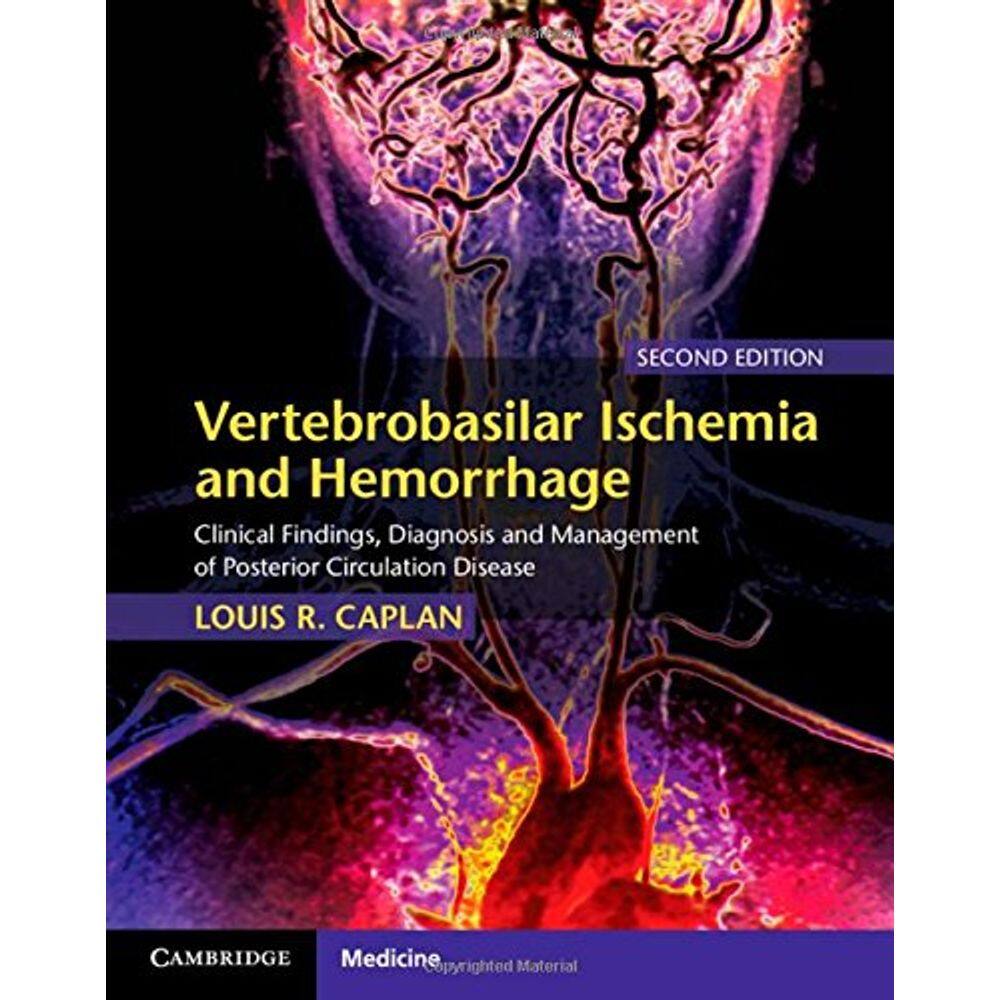 Vertebrobasilar Ischemia And Hemorrhage