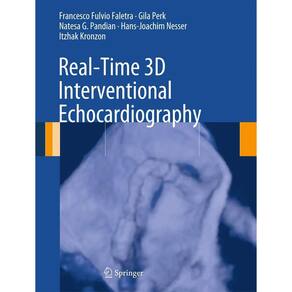 Real Time 3D Interventional Echocardiography