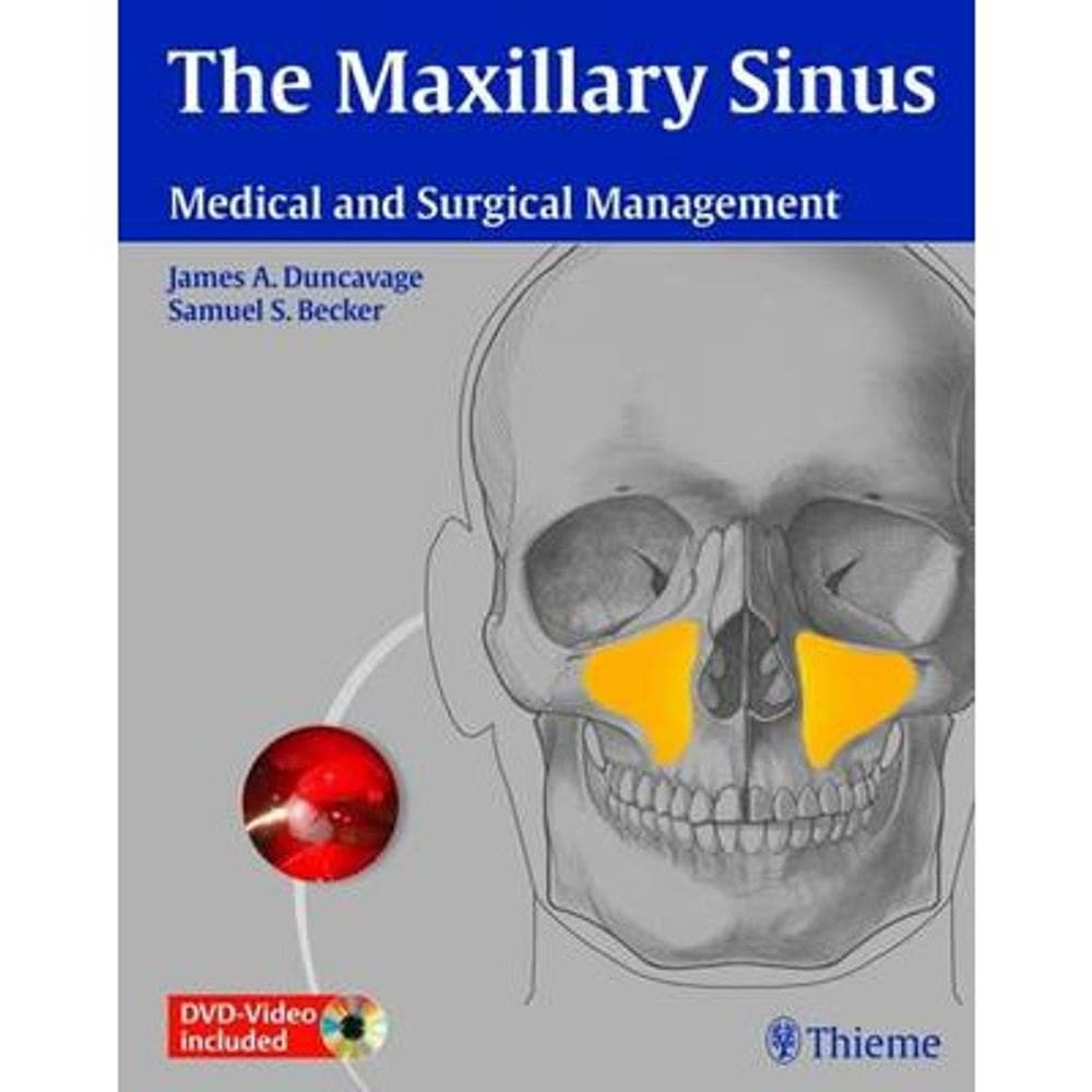 The Maxillary Sinus