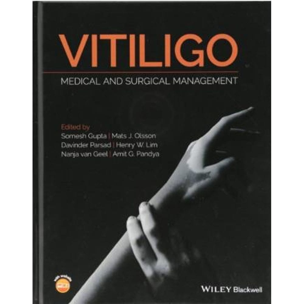 Vitiligo: Medical And Surgical Management