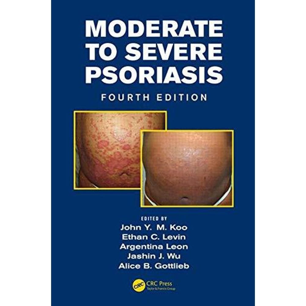 Mild To Moderate And Moderate To Severe Psoriasis Set