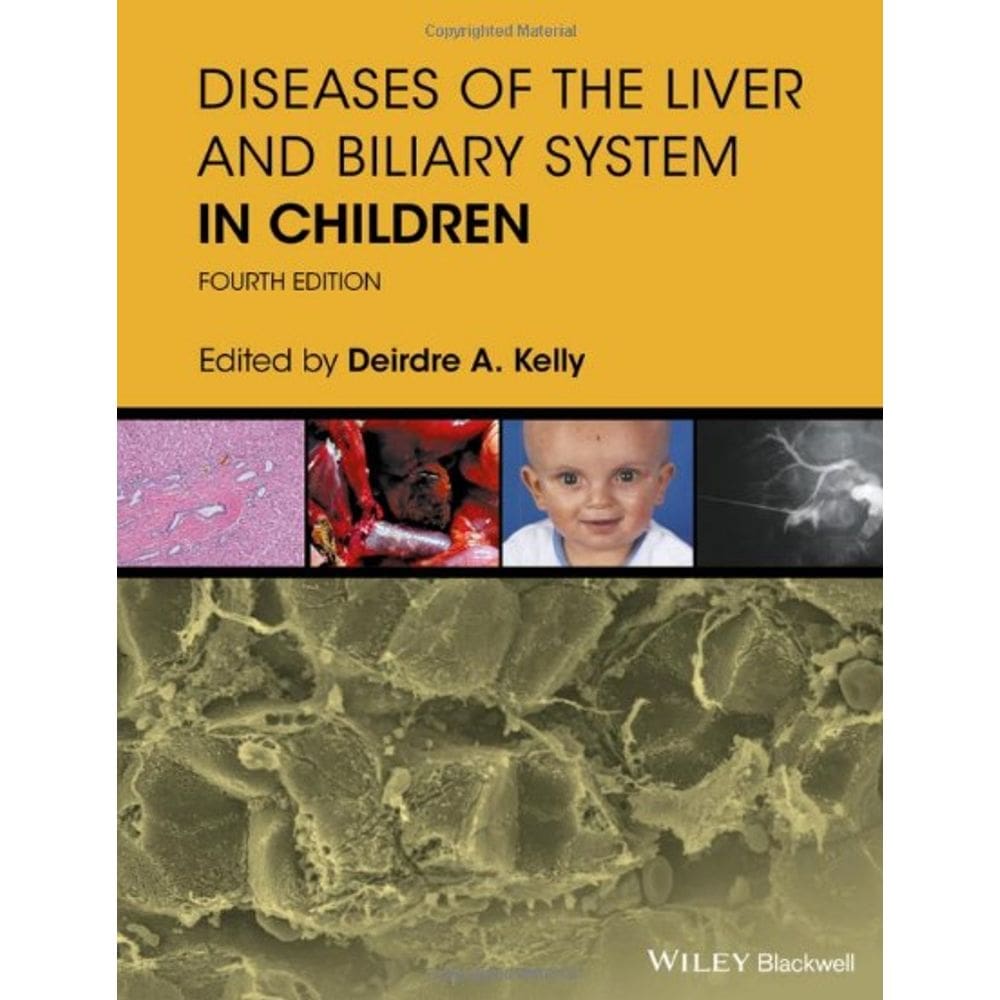 Diseases Of The Liver And Biliary System In Children