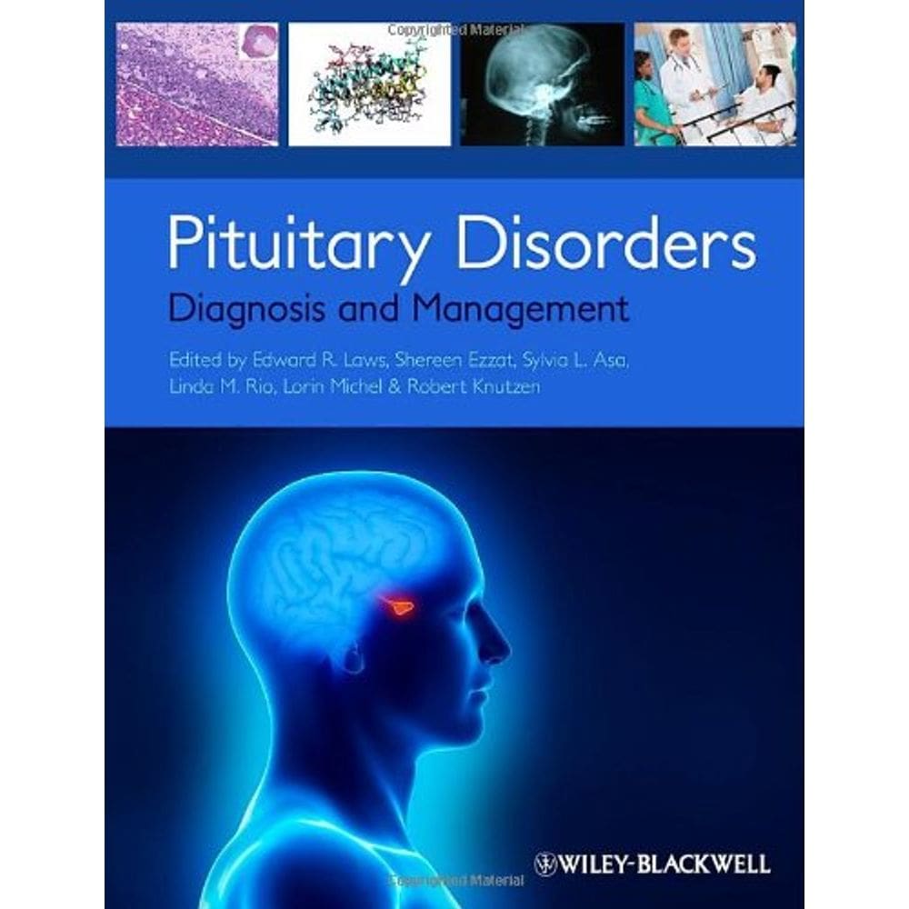Pituitary Disorders Diagnosis And Management