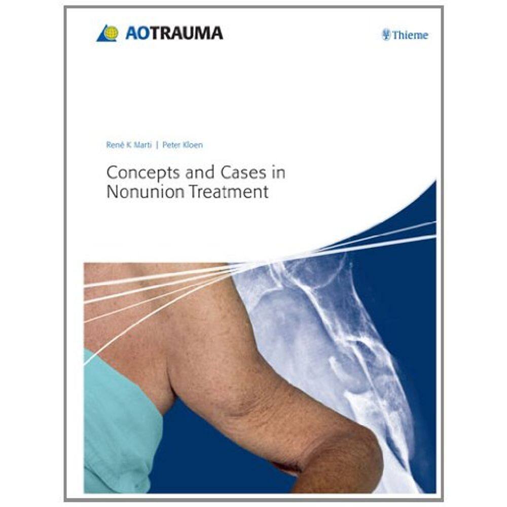 Concepts And Cases In. Nonunion Treatment.