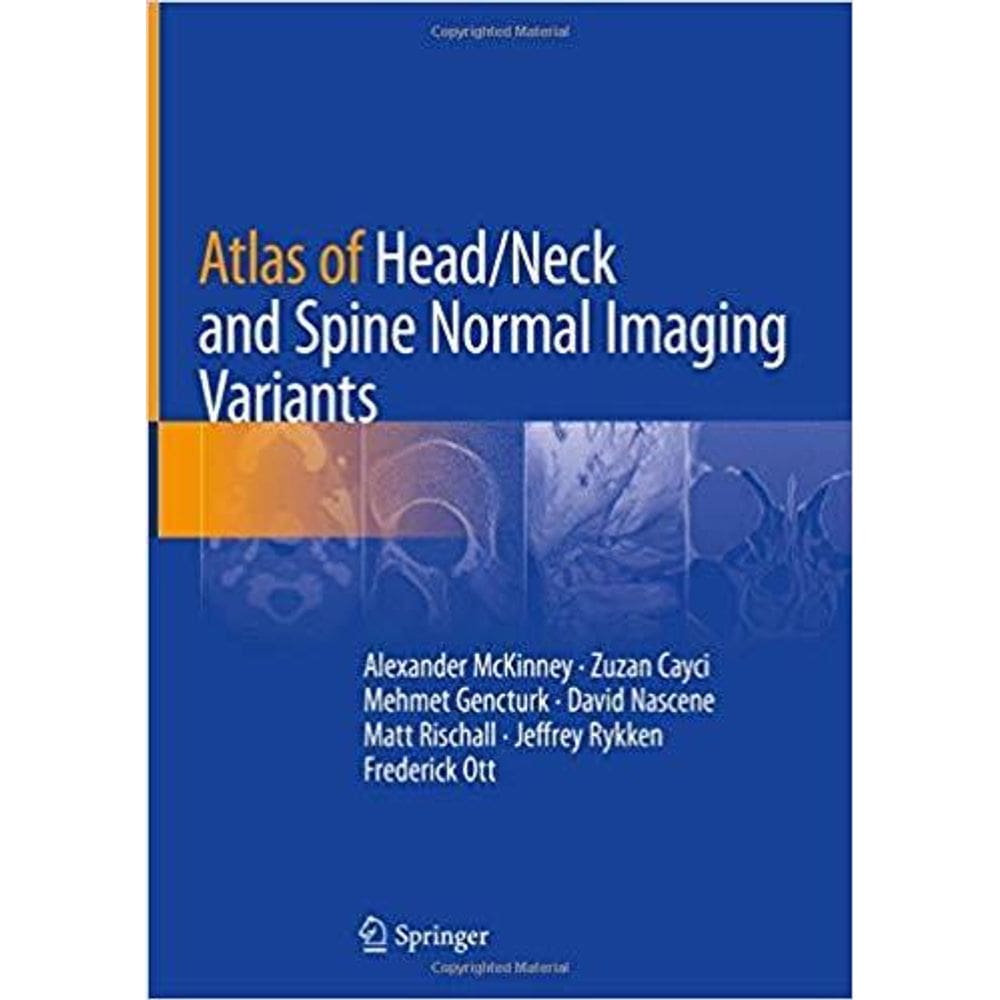 Atlas Of Head Neck And Spine Normal Imaging Variants