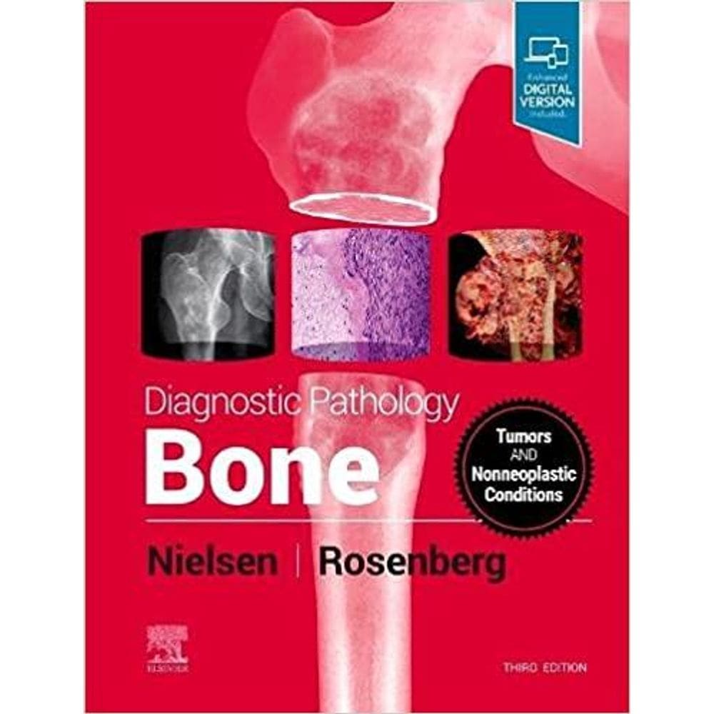 Diagnostic Pathology: Bone