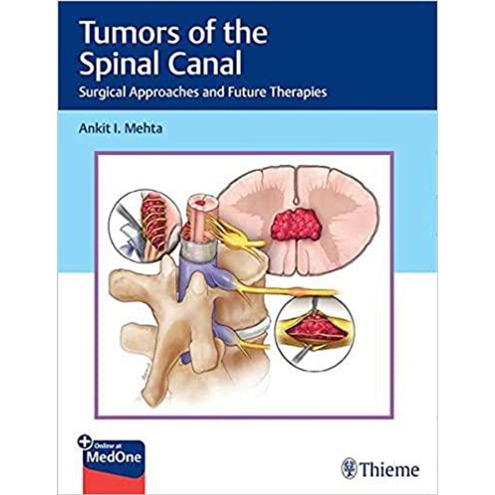 Tumors Of The Spinal Canal