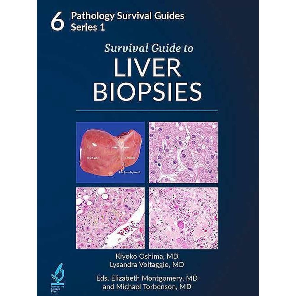 Survival Guide To Liver Biopsies