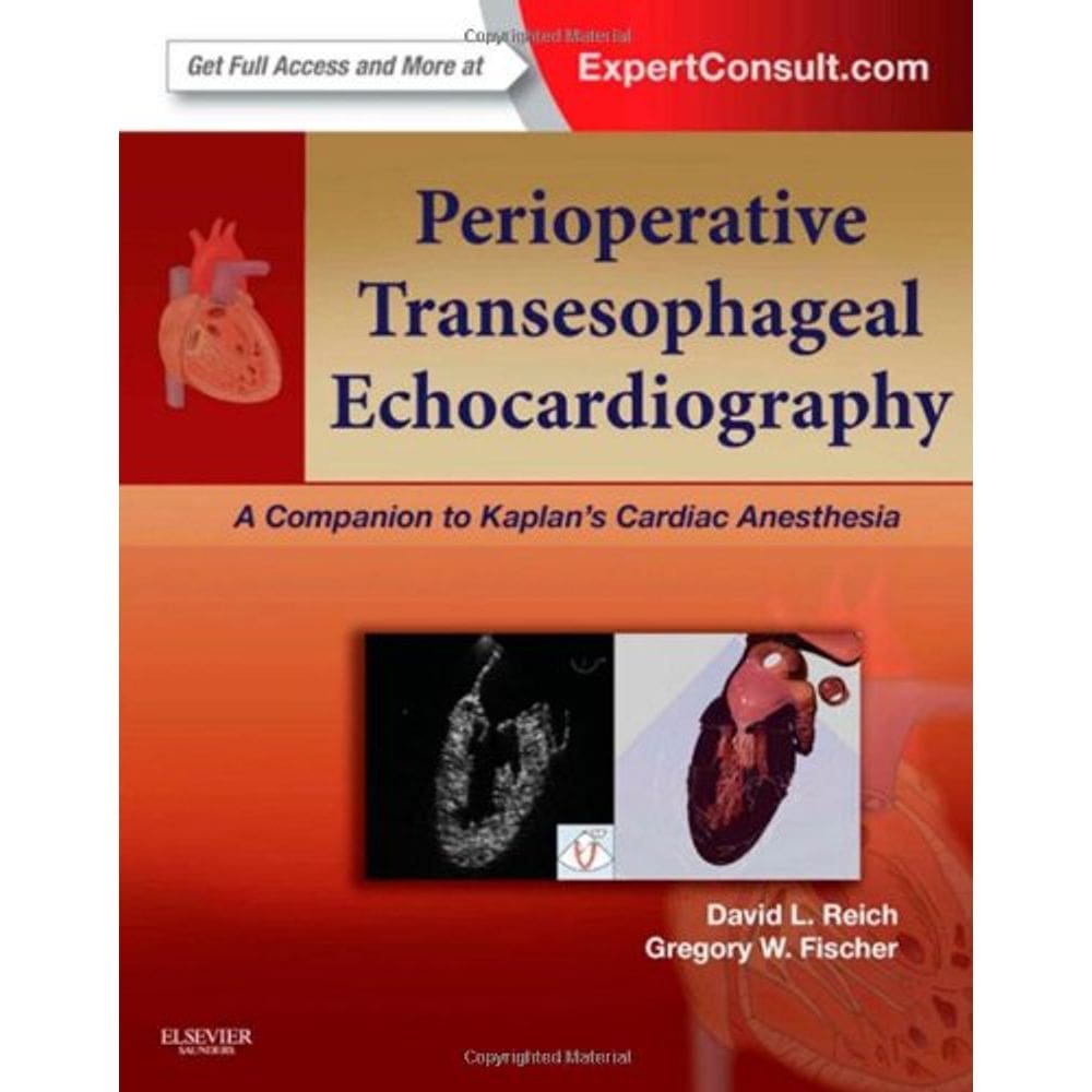 Prioperative Transesophageal Echocardiography