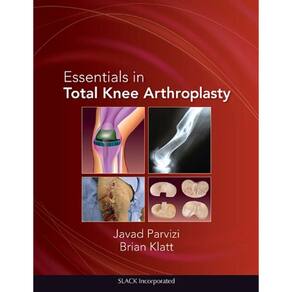 Essentials In Total Knee Arthroplasty