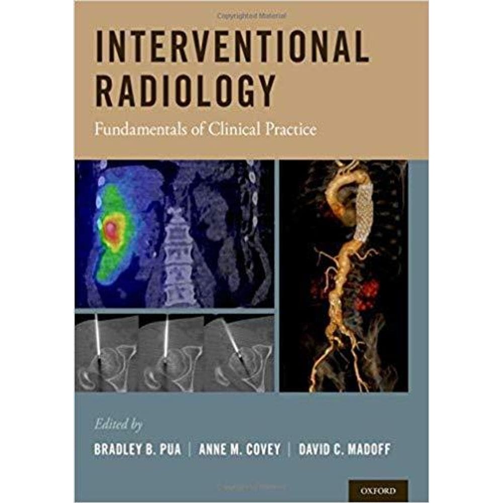 Interventional Radiology