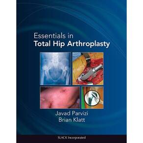 Essentials In Total Hip Arthroplasty