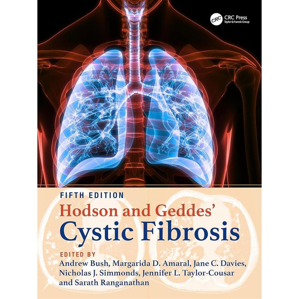 Hodson And Geddes Cystic Fibrosis