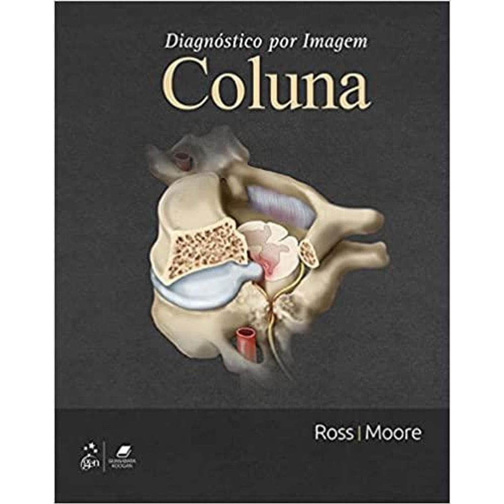 Diagnostico Por Imagem Coluna