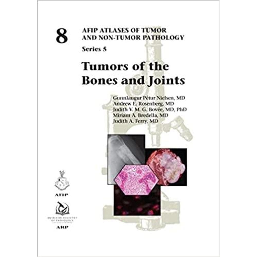 Tumors Of The Bones And Joints