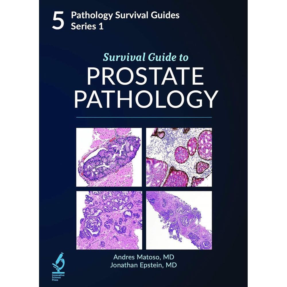 Survival Guide To Prostate Pathology