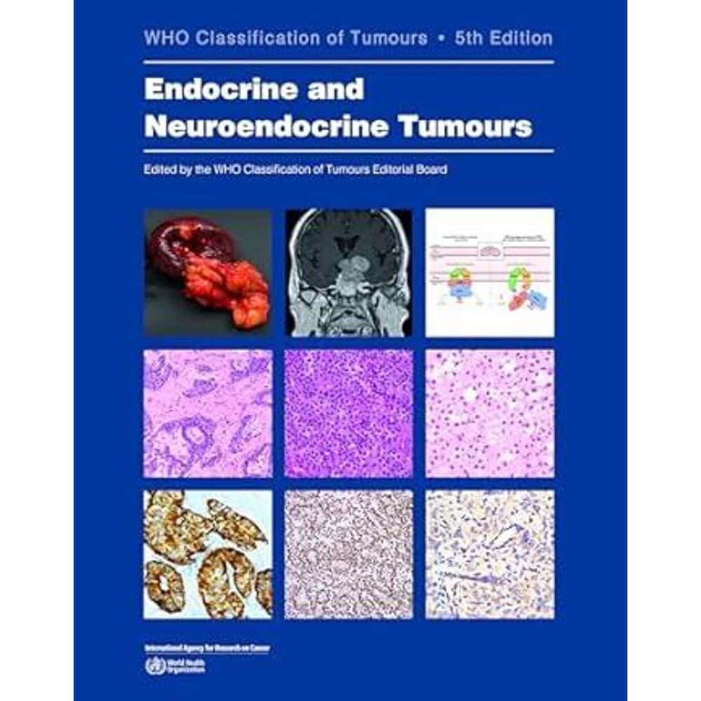 Endocrine And Neuroendocrine Tumours