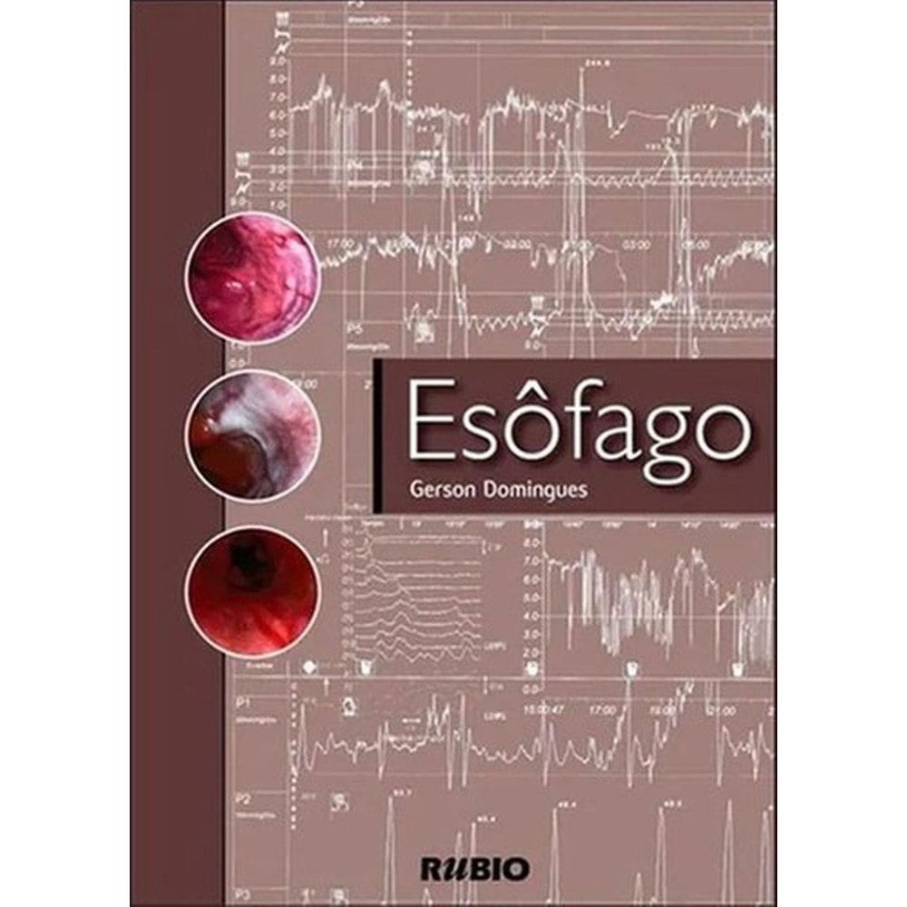 Livro: Esôfago Medicina, Anatomia E Fisiologia