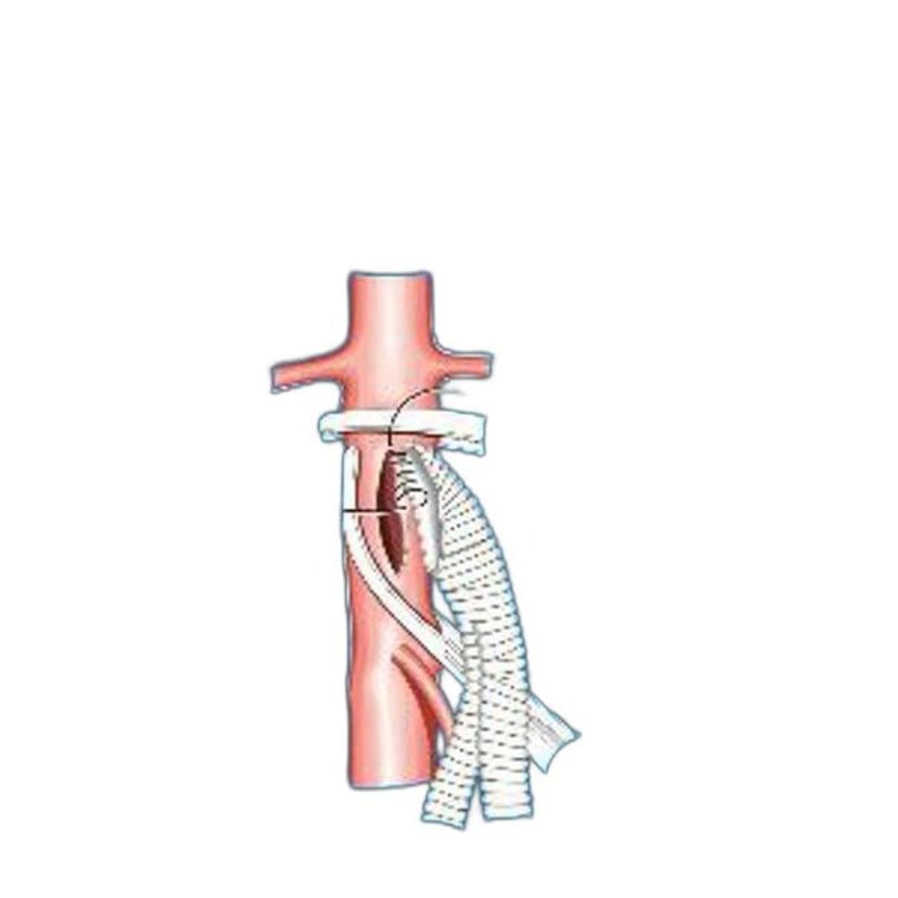 Livro Cirurgia Vascular