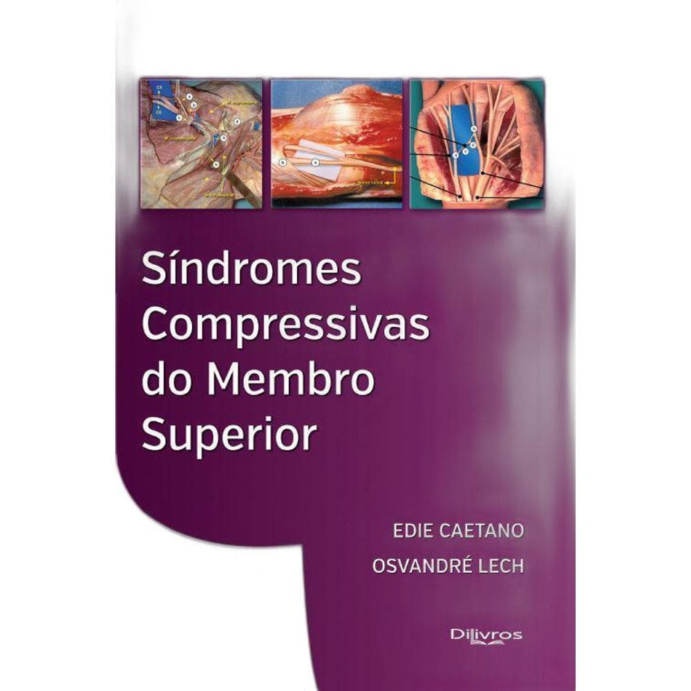 Livro Síndromes Compressivas Do Membro Superior
